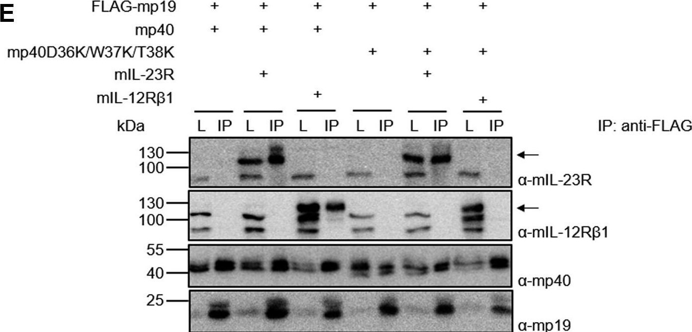 Detection of IL-12 R beta 1 by Western Blot