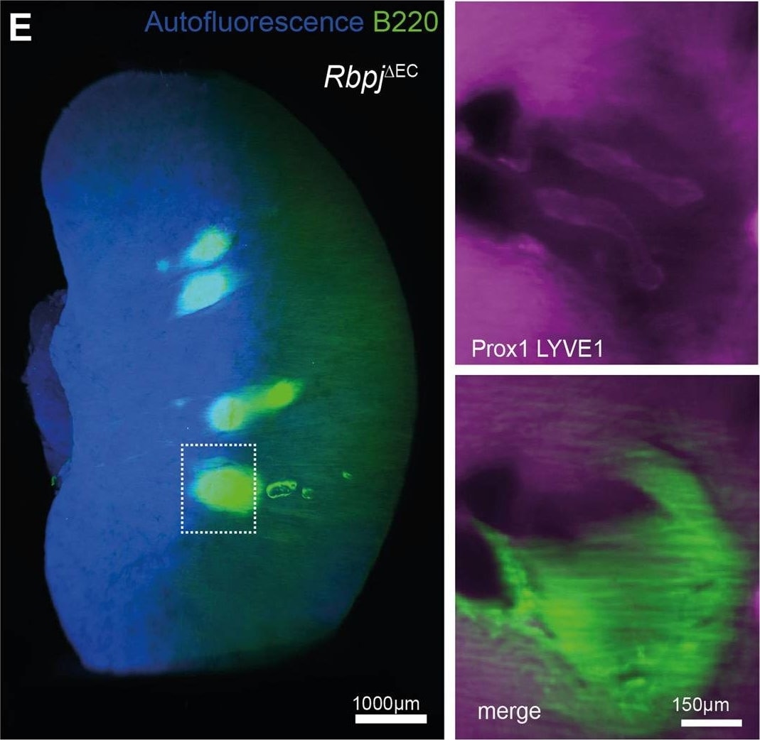 Detection of Mouse LYVE-1 by Immunohistochemistry