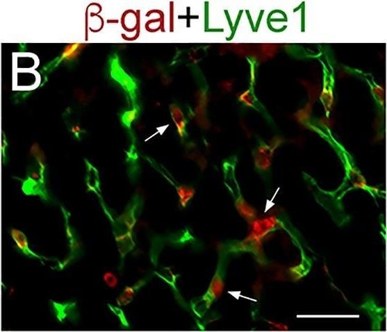 Detection of Mouse LYVE-1 by Immunohistochemistry