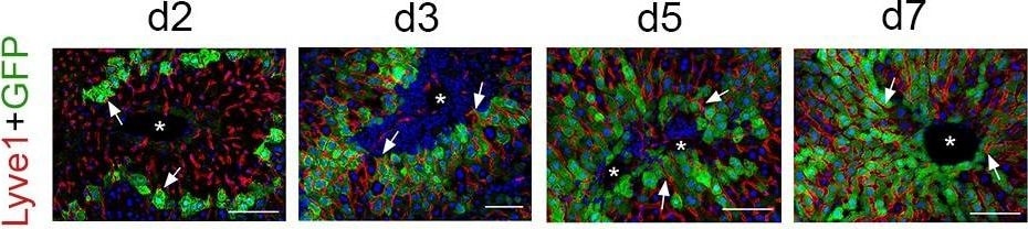 Detection of Mouse LYVE-1 by Immunohistochemistry