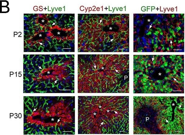 Detection of Mouse LYVE-1 by Immunohistochemistry