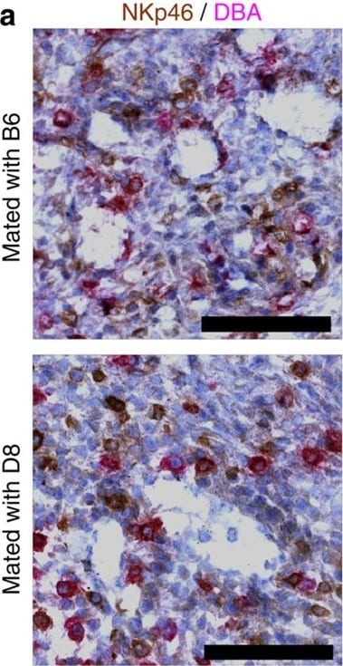 Detection of Mouse NKp46/NCR1 by Immunocytochemistry/Immunofluorescence