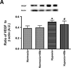 Detection of Rat VEGF by Western Blot