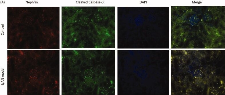 Detection of Nephrin by Immunohistochemistry