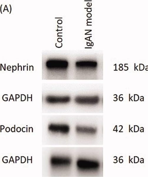Detection of Nephrin by Western Blot