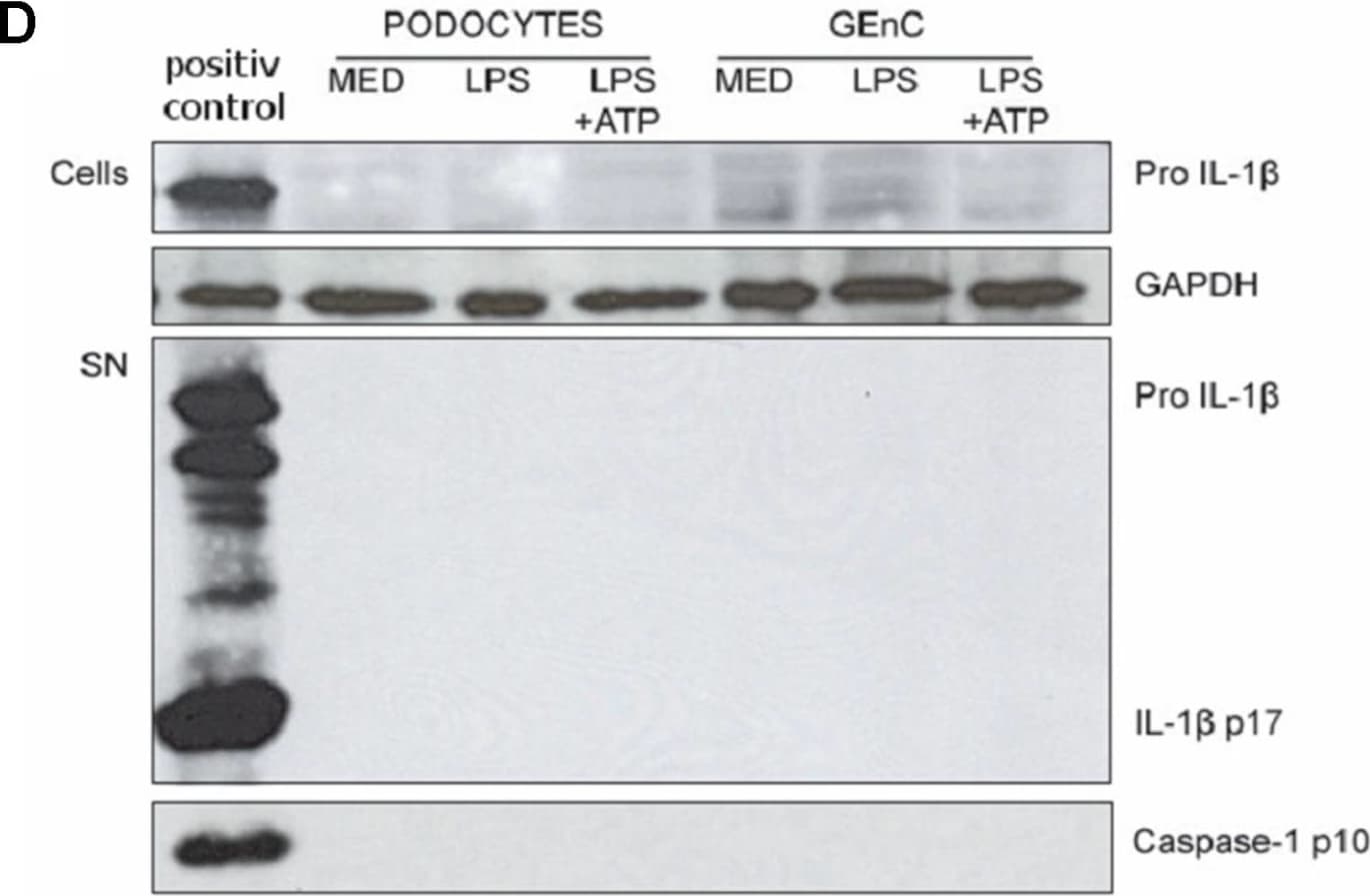 Detection of IL-1 beta/IL-1F2 by Western Blot