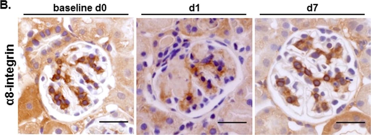 Detection of Mouse Integrin alpha 8 by Immunocytochemistry/Immunofluorescence