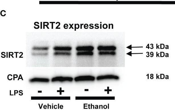 Detection of Sirtuin 2/SIRT2 by Western Blot