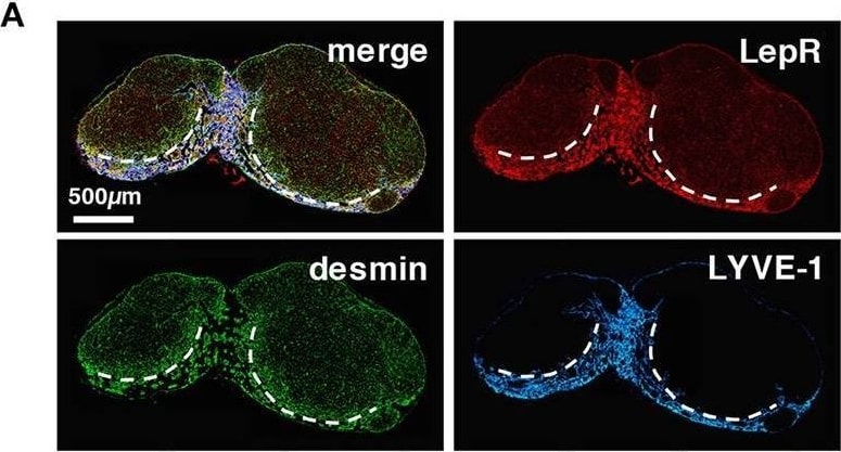 Detection of Mouse Leptin R by Immunohistochemistry