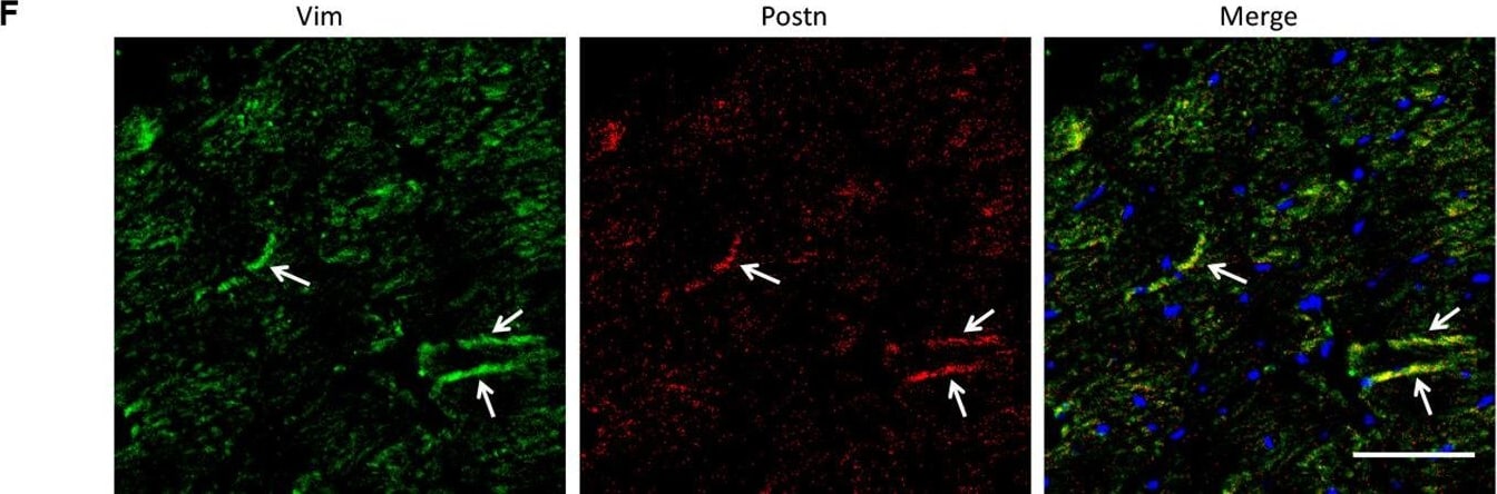 Detection of Mouse Vimentin by Immunohistochemistry