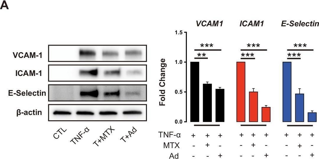Detection of E-Selectin/CD62E by Western Blot