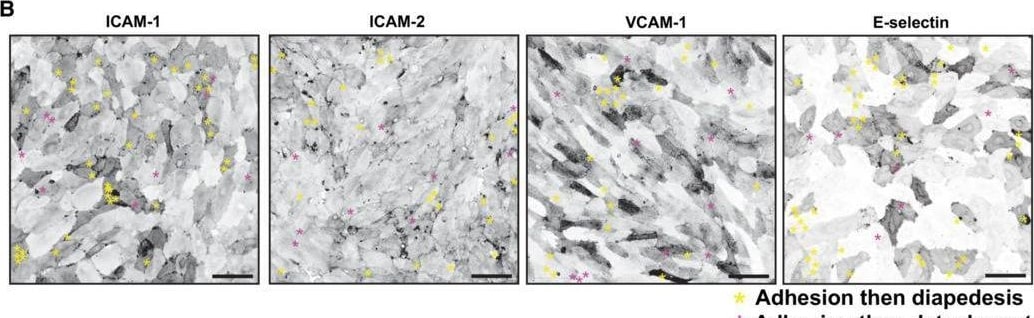 Detection of E-Selectin/CD62E by Immunohistochemistry