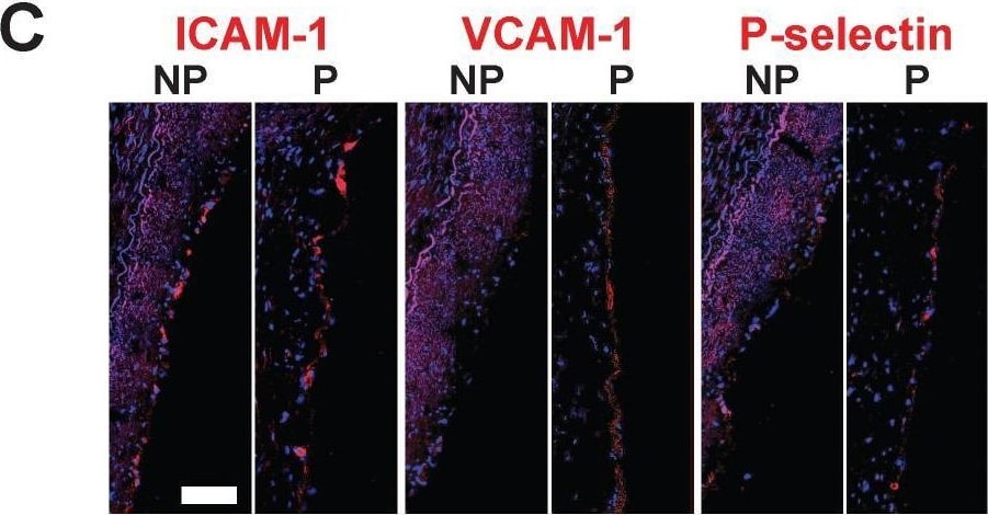 Detection of P-Selectin/CD62P by Immunohistochemistry