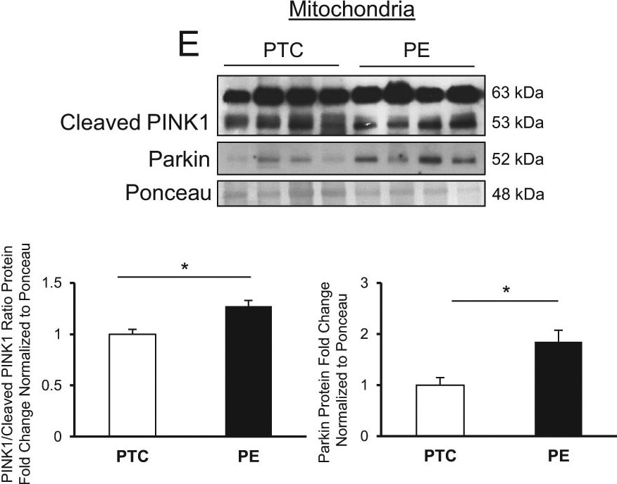 PINK1 Antibody - BSA Free