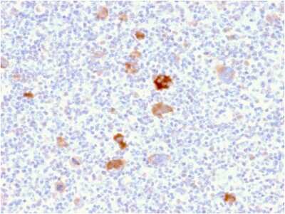 Immunohistochemistry-Paraffin: bcl-x Antibody (BCL2L1/2406) - Azide and BSA Free [NBP3-08777]