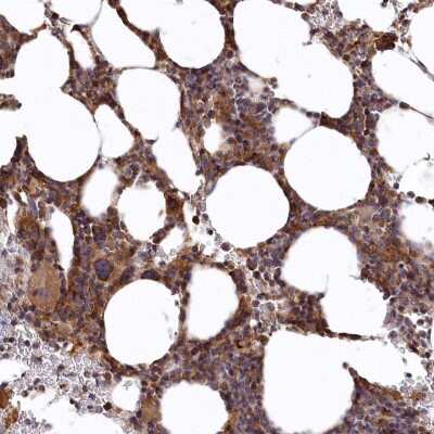 Immunohistochemistry-Paraffin: bcl10-interacting CARD protein Antibody [NBP2-38125]