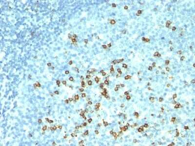 Immunohistochemistry-Paraffin: CD57 Antibody (HNK-1 + NK-1) [NBP2-44354]