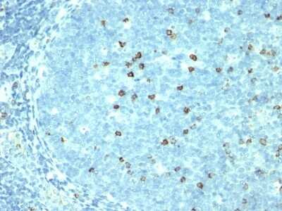 Immunohistochemistry-Paraffin: CD57 Antibody (SPM527) [NBP2-44351]