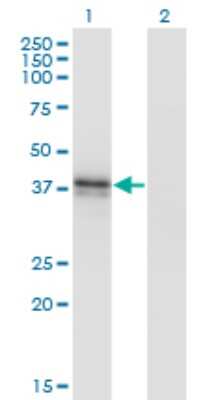 Western Blot: beta-1,3-Glucuronyltransferase 3/B3GAT3 Antibody (1C11) [H00026229-M02]