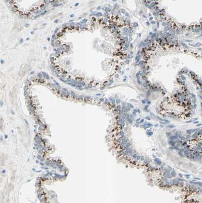 Immunohistochemistry-Paraffin: beta-1,4-Galactosyltransferase 1/B4GalT1 Antibody [NBP1-88655]