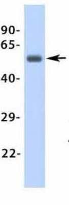Western Blot: beta-1 Adrenergic R/ADRB1 Antibody [NBP1-59007]