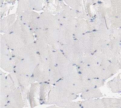 Immunohistochemistry-Paraffin: beta-2 Adrenergic R/ADRB2 Antibody [NBP1-90227]