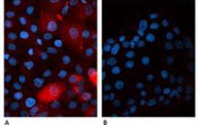 Immunocytochemistry/ Immunofluorescence: beta 2-Microglobulin Antibody (B2M-01) - BSA Free [NB500-317]