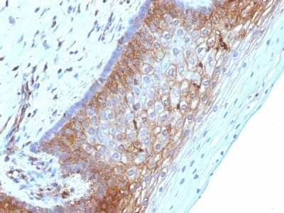 Immunohistochemistry-Paraffin: beta 2-Microglobulin Antibody (B2M/1118) - Azide and BSA Free [NBP2-47702]