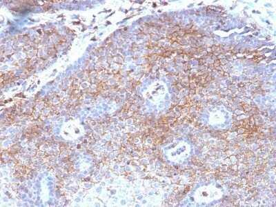 Immunohistochemistry-Paraffin: beta 2-Microglobulin Antibody (B2M/1118) - Azide and BSA Free [NBP2-47702]