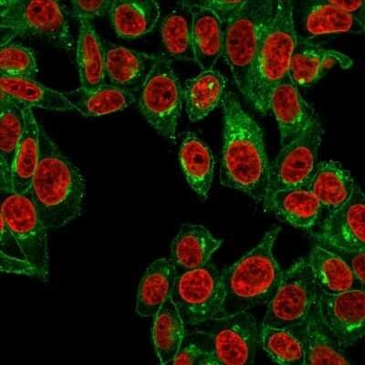 Immunocytochemistry/ Immunofluorescence: beta 2-Microglobulin Antibody (B2M/961) - Azide and BSA Free [NBP2-47704]