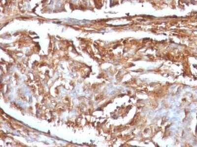 Immunohistochemistry-Paraffin: beta 2-Microglobulin Antibody (B2M/961) - Azide and BSA Free [NBP2-47704]