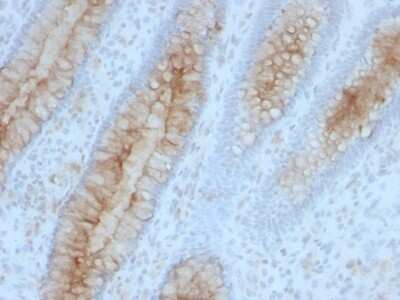 Immunohistochemistry-Paraffin: beta 2-Microglobulin Antibody (B2M/961) - Azide and BSA Free [NBP2-47704]