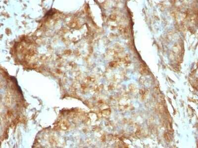 Immunohistochemistry-Paraffin: beta 2-Microglobulin Antibody (B2M/961) - Azide and BSA Free [NBP2-47704]