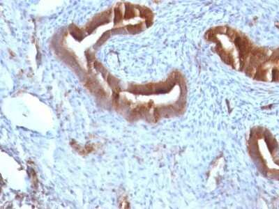 Immunohistochemistry-Paraffin: beta 2-Microglobulin Antibody (B2M/961) - Azide and BSA Free [NBP2-47704]