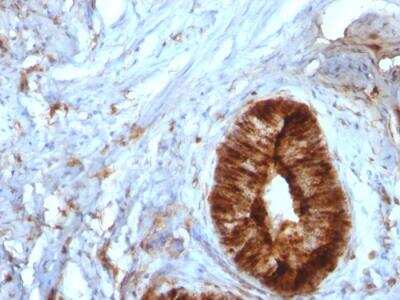 Immunohistochemistry-Paraffin: beta 2-Microglobulin Antibody (B2M/961) - IHC-Prediluted [NBP2-48345]