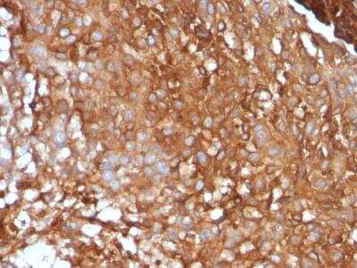 Immunohistochemistry-Paraffin: beta 2-Microglobulin Antibody (B2M/961) - IHC-Prediluted [NBP2-48345]