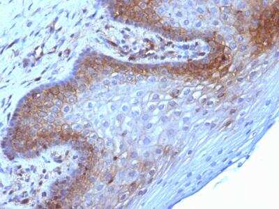 Immunohistochemistry-Paraffin: beta 2-Microglobulin Antibody (B2M/961) - IHC-Prediluted [NBP2-48345]