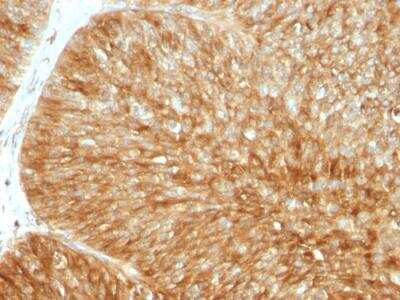 Immunohistochemistry-Paraffin: beta 2-Microglobulin Antibody (B2M/961) - IHC-Prediluted [NBP2-48345]