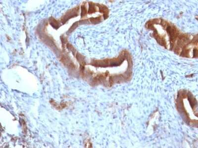 Immunohistochemistry-Paraffin: beta 2-Microglobulin Antibody (B2M/961) [NBP2-44471]