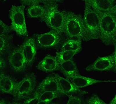 Immunocytochemistry/ Immunofluorescence: beta 2-Microglobulin Antibody (C21.48A1) - Azide and BSA Free [NBP3-11404]