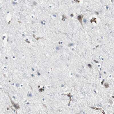 Immunohistochemistry-Paraffin: beta 2-Microglobulin Antibody [NBP1-87482]