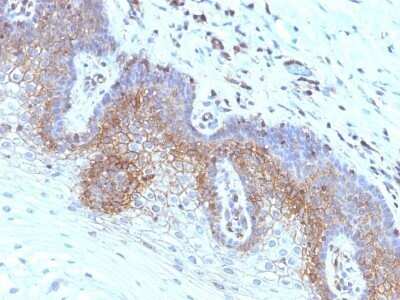 Immunohistochemistry-Paraffin: beta 2-Microglobulin Antibody (SPM617) - Azide and BSA Free [NBP2-47703]