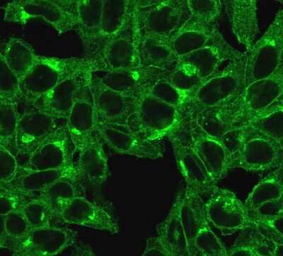 Immunocytochemistry/ Immunofluorescence: beta 2-Microglobulin Antibody (SPM617) [NBP2-44468]