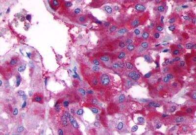 Immunohistochemistry-Paraffin: beta-3 Adrenergic R/ADRB3 Antibody - BSA Free [NLS4198]