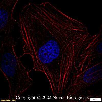 Immunocytochemistry/ Immunofluorescence: beta-Actin Antibody (8H10D10) - BSA Free [NBP1-47423]
