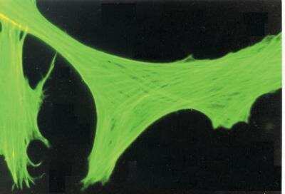 Immunocytochemistry/ Immunofluorescence: beta-Actin Antibody (AC-15) [NB600-501]