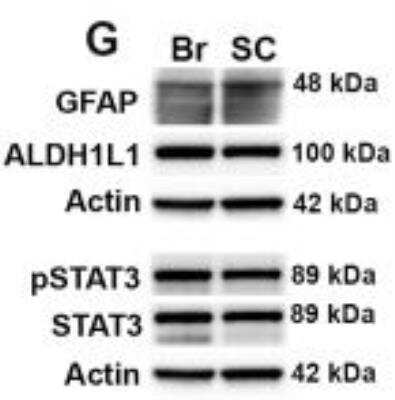 Western Blot: beta-Actin Antibody (AC-15) [NB600-501]