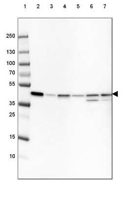 Western Blot: beta-Actin Antibody (CL3868) [NBP2-76481]