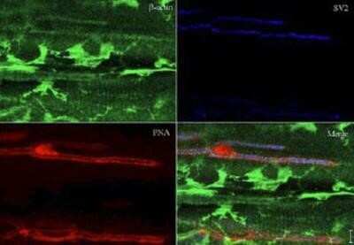 Immunohistochemistry: beta-Actin Antibody [NB600-505]
