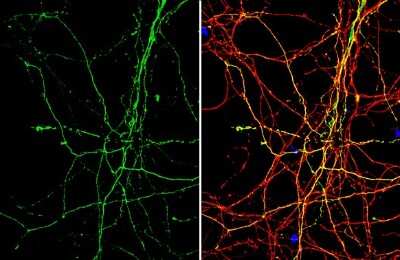 Immunocytochemistry/ Immunofluorescence: beta-Alanine Antibody [NBP3-13408]